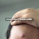 weclg(外耳长了个脓包是什么原因)