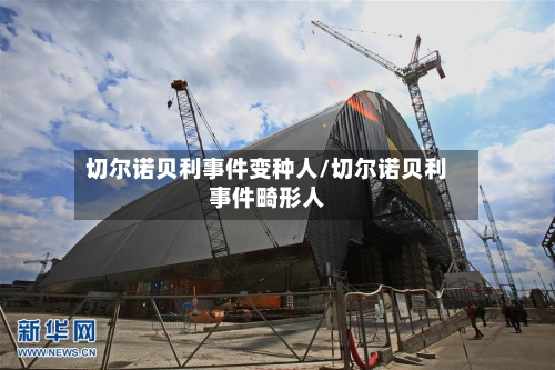 切尔诺贝利事件变种人/切尔诺贝利事件畸形人-第2张图片