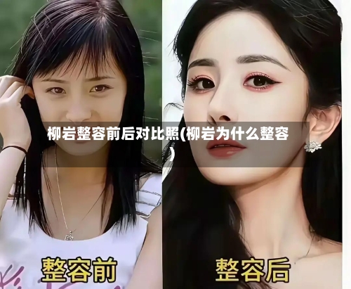 柳岩整容前后对比照(柳岩为什么整容)-第2张图片