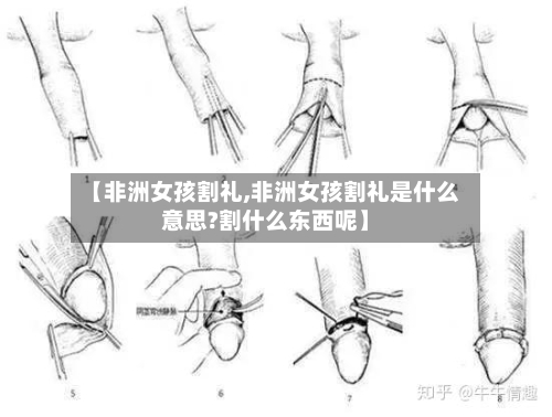 【非洲女孩割礼,非洲女孩割礼是什么意思?割什么东西呢】-第2张图片