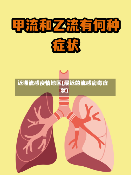 近期流感疫情地区(最近的流感病毒症状)-第3张图片