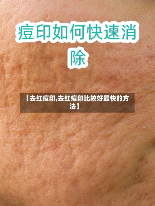【去红痘印,去红痘印比较好最快的方法】-第2张图片